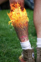 my leg is on fire, literally